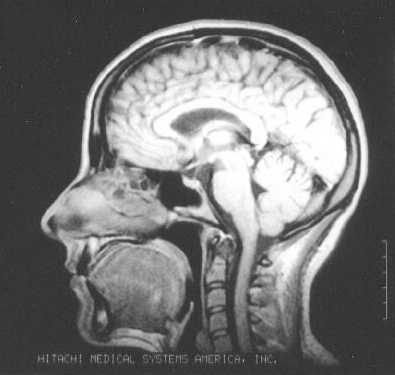 head x-ray